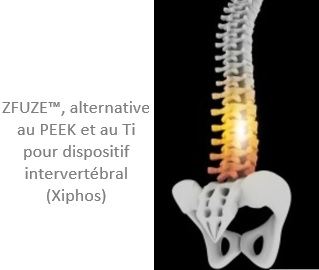 ZFUZE™, alternative au PEEK et au Ti pour dispositif intervertébral (Xiphos)