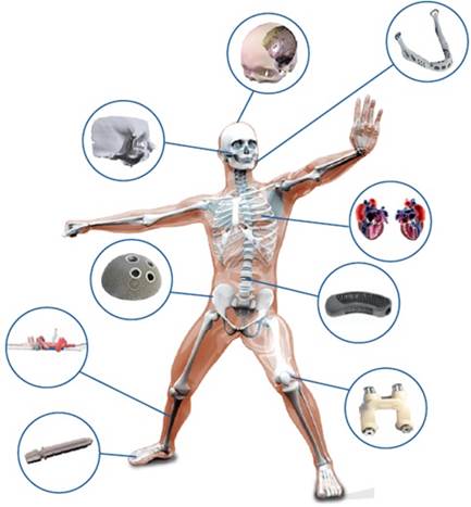 Implants 3D Systems Healthcare (BE) par fabrication additive
